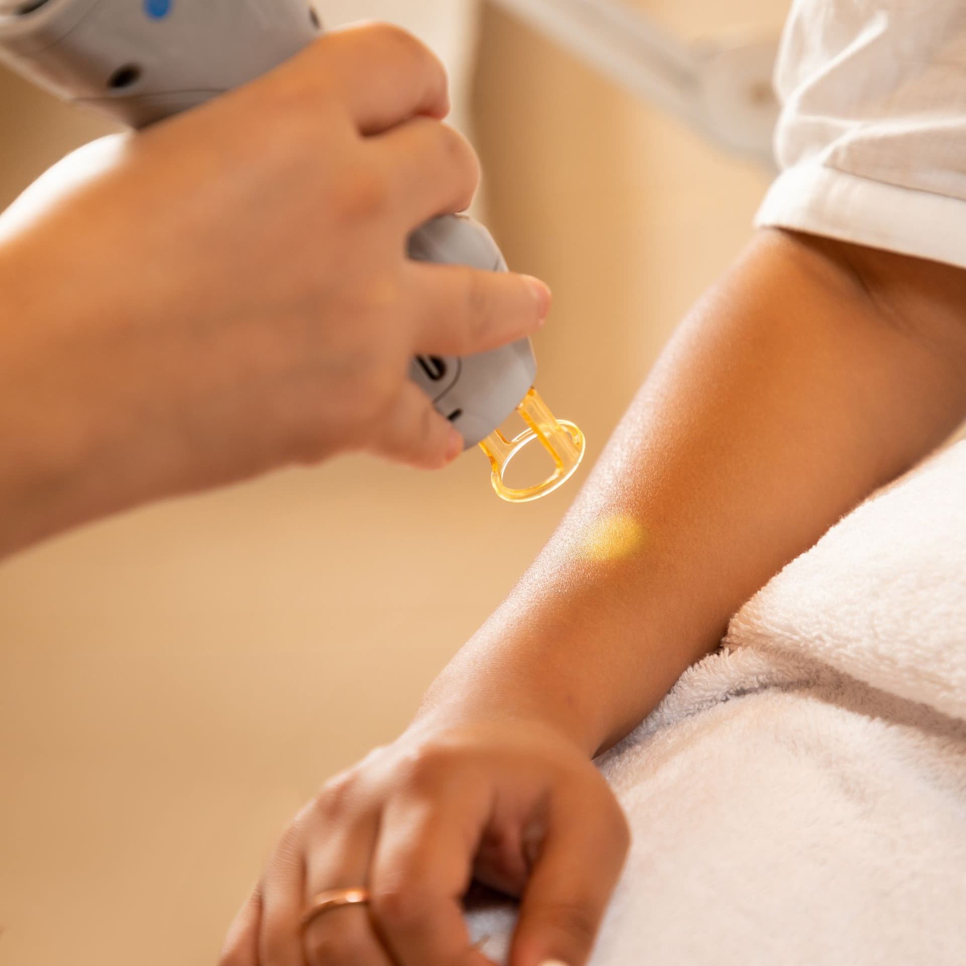 The AEDIT team covers Why August Is the Perfect Time to Start Laser Hair Removal.