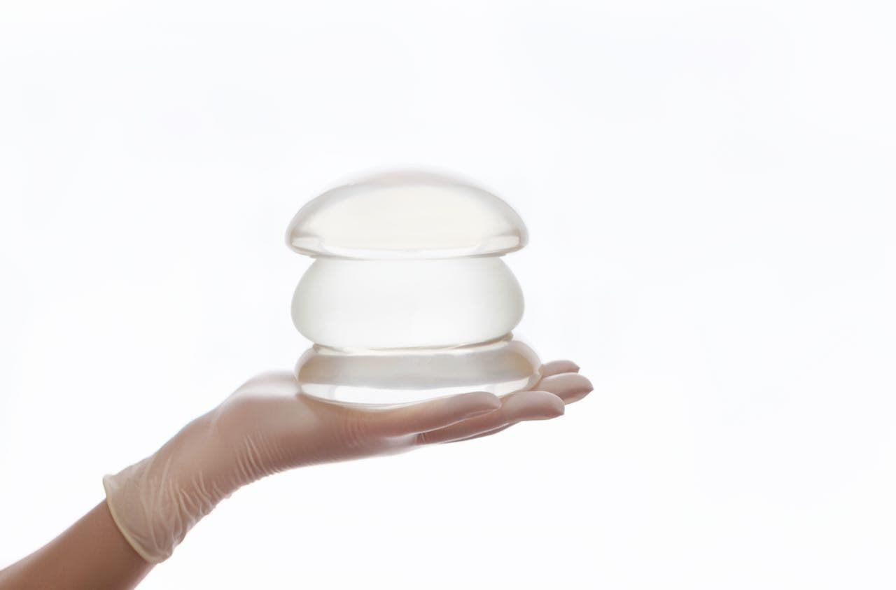What Happens When You Have Breast Implants Removed