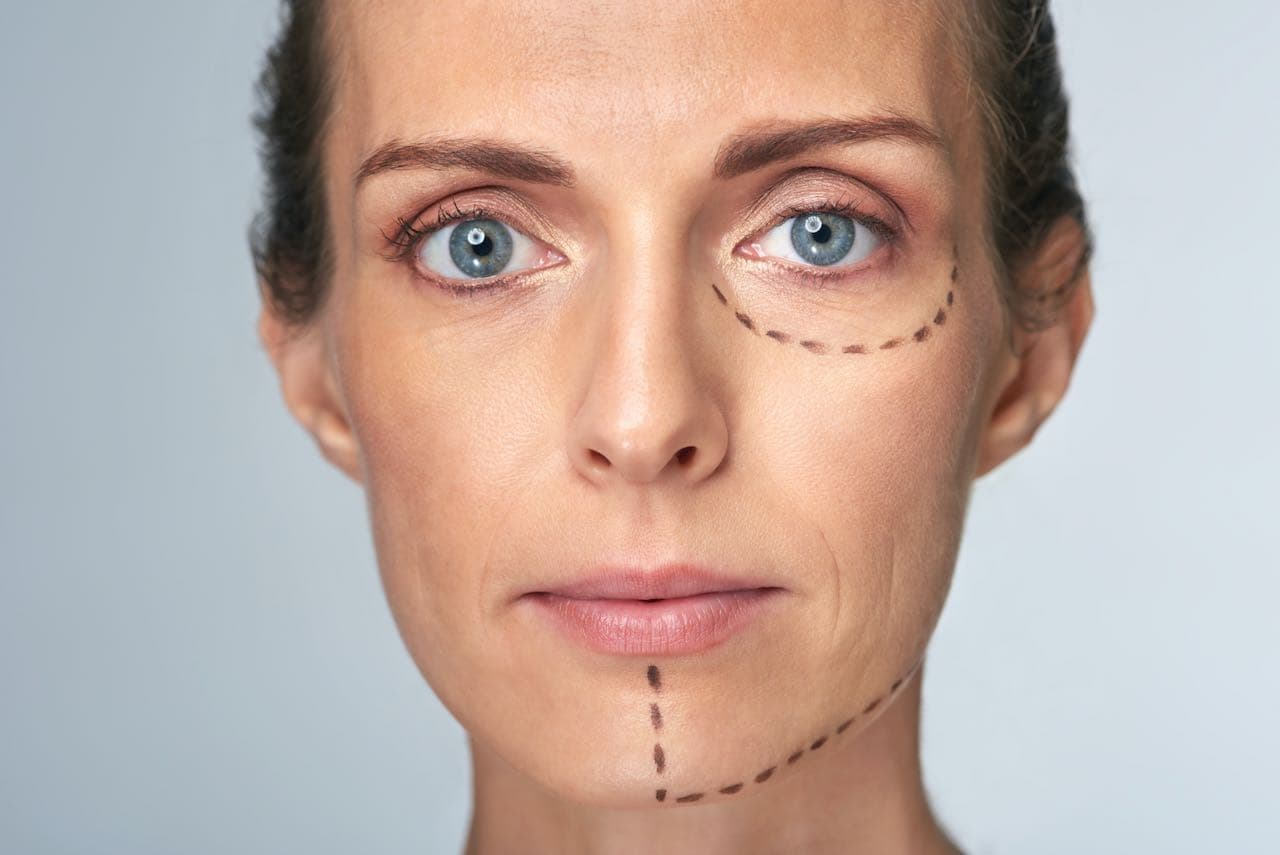 What Kind Of Scarring You Can Expect From Popular Facial Procedures