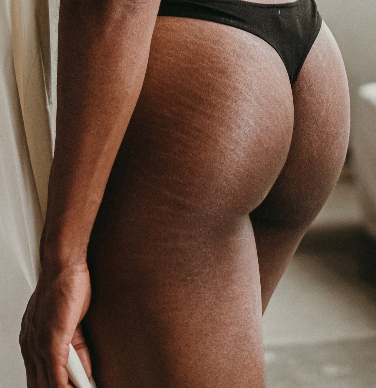 Every Treatment And Procedure That Helps Minimize Stretch Marks
