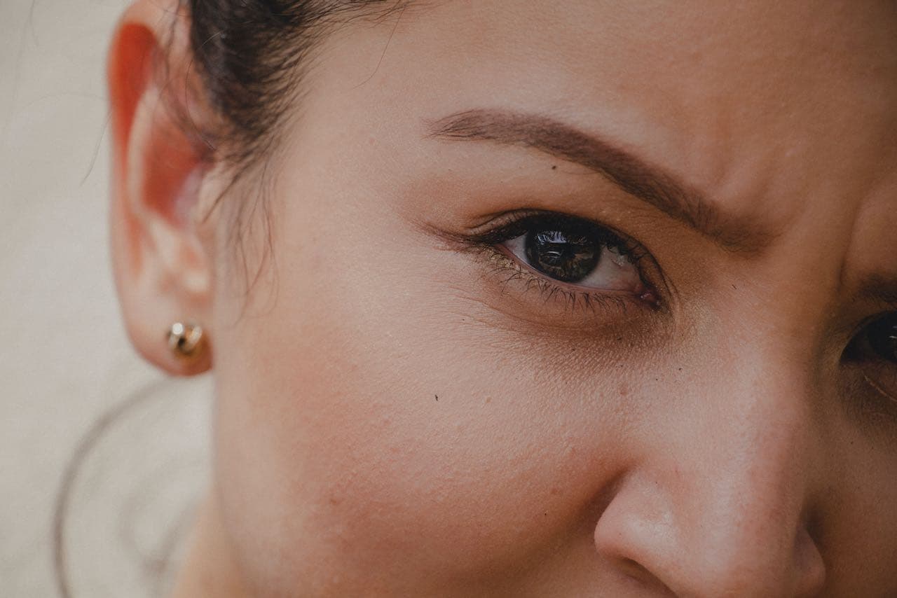 Why I Switched From Botox To Dysport To Treat My Fine Lines