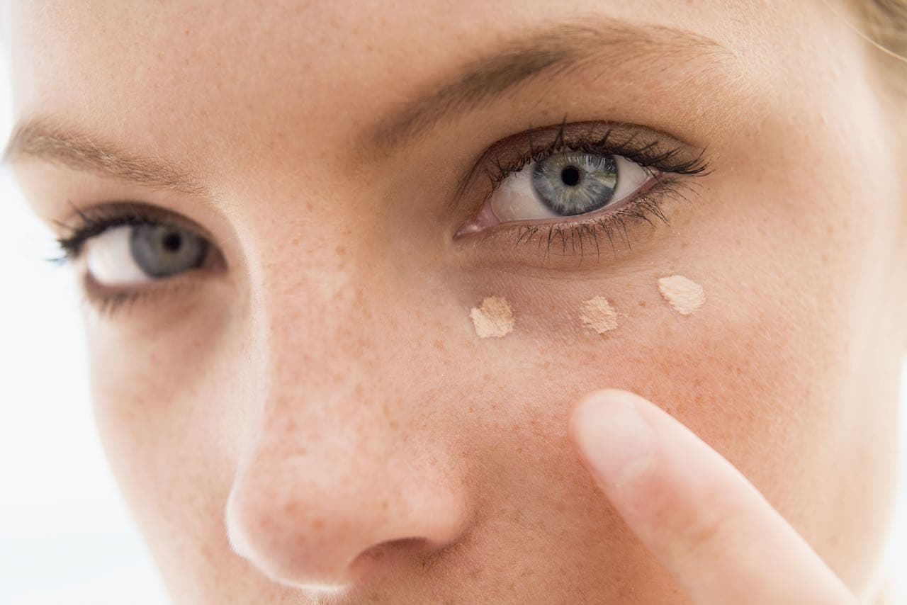 Injectable And Laser Bruising: How To Prevent, How To Conceal, How To Deal
