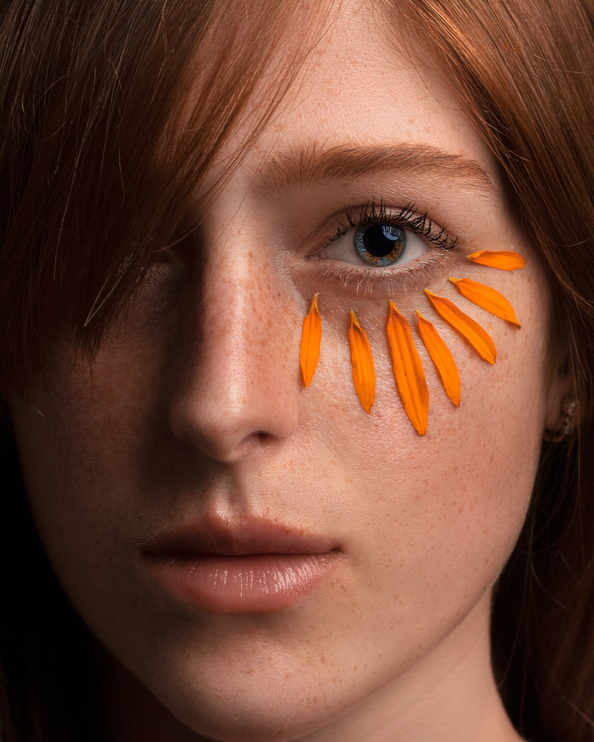 Are You a Candidate for Under Eye Filler? Here’s How to Tell