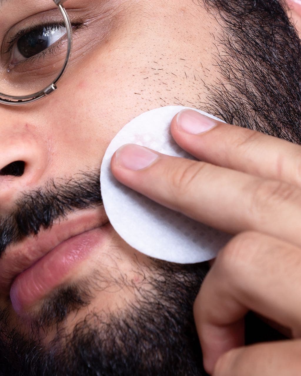 How To Treat Adult Acne In Men
