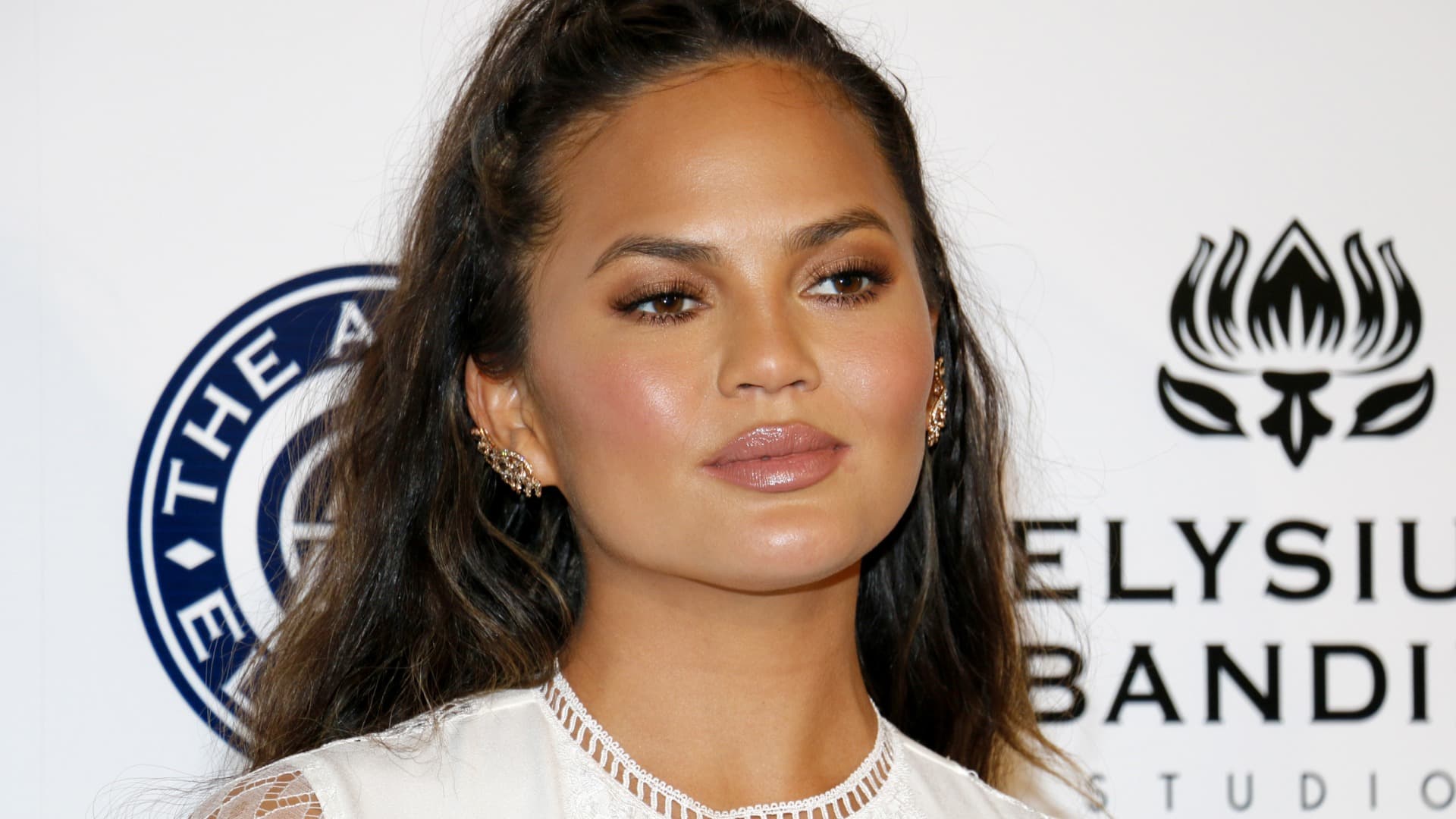 What You Need To Know About Chrissy Teigen's Armpit Botox