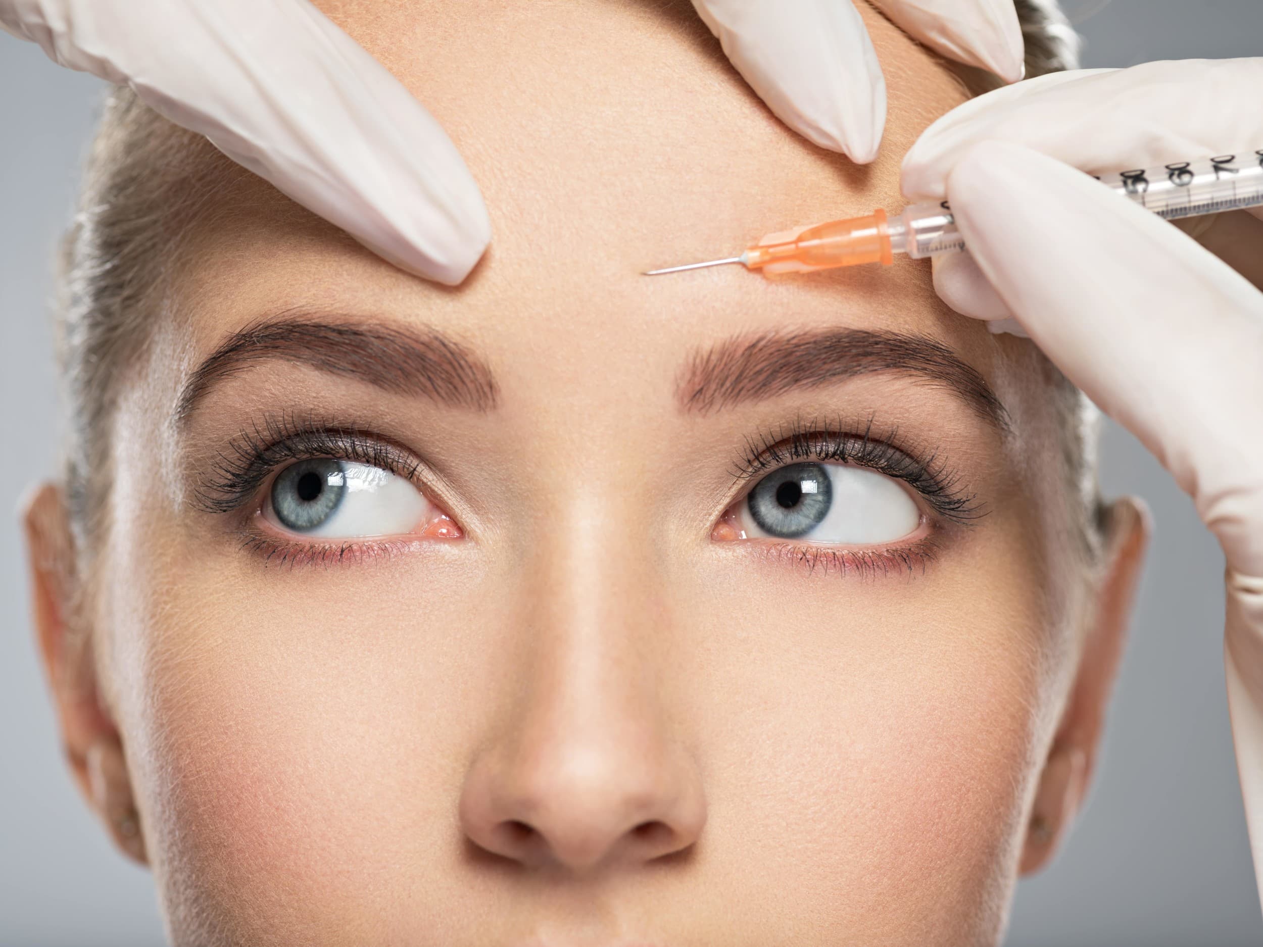 Can You Be Too Young for Botox?