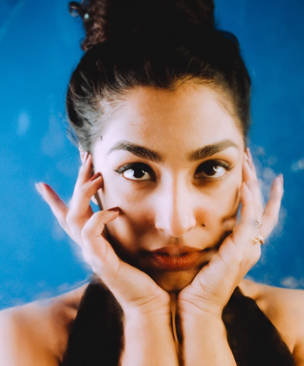 What It’s Really Like To Get A Revision Rhinoplasty