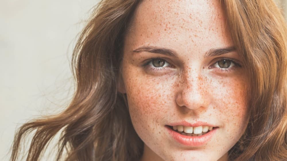What's The Difference Between Freckles And Sun Spots?