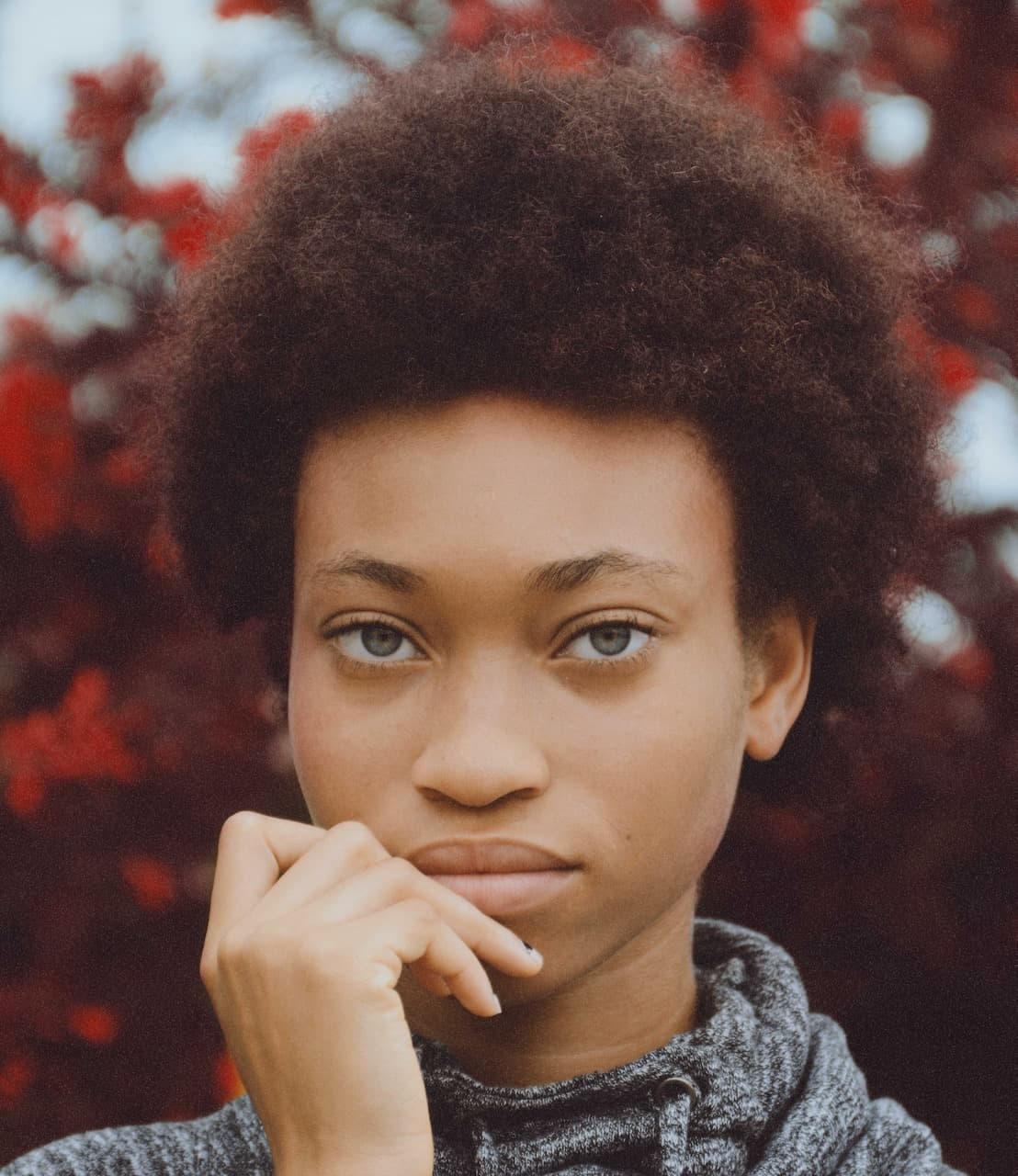 Are Your Dark Circles Actually Hyperpigmentation?