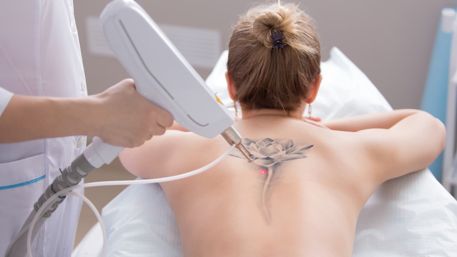 The Truth About Laser Tattoo Removal