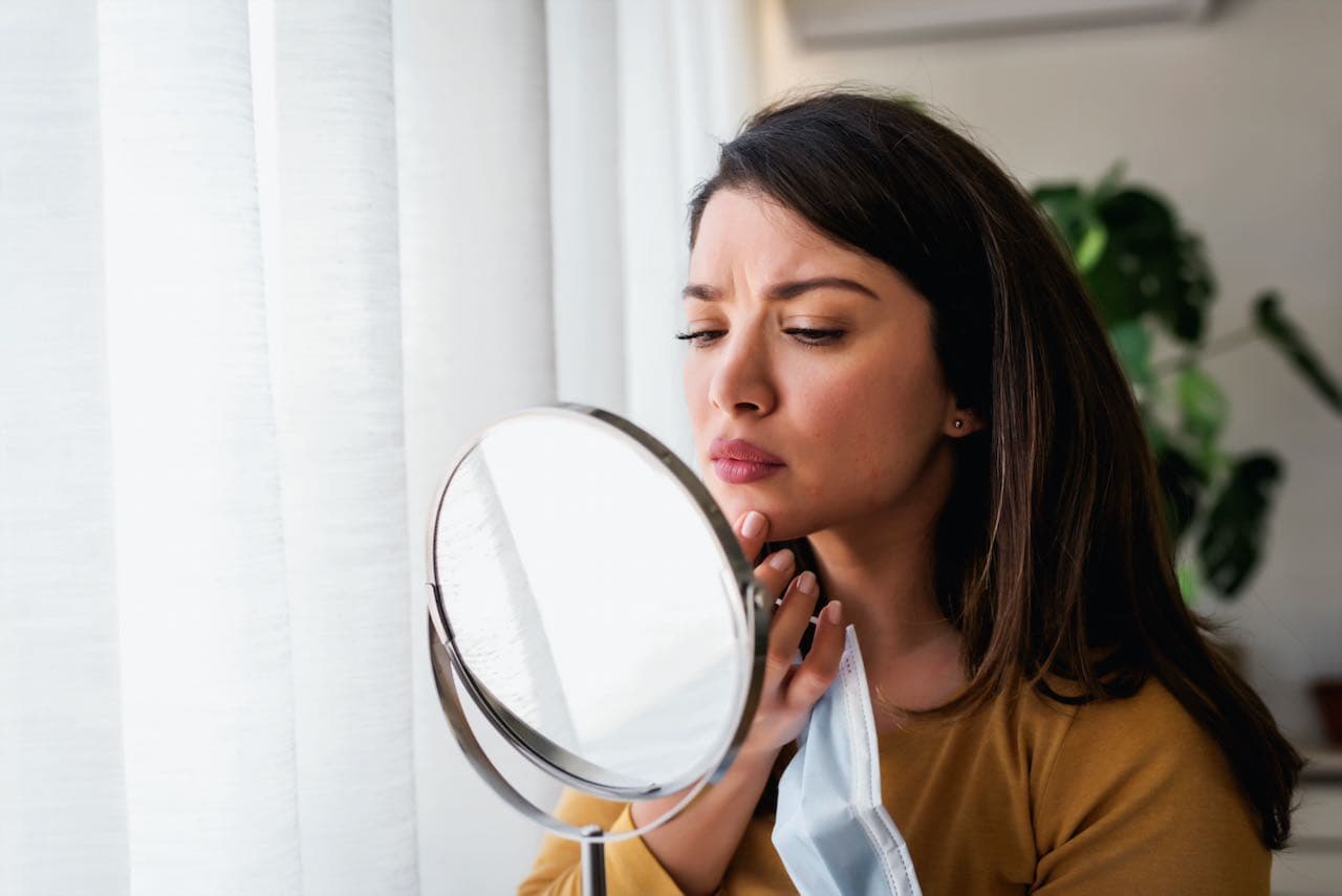 How To Get Rid Of A Pimple