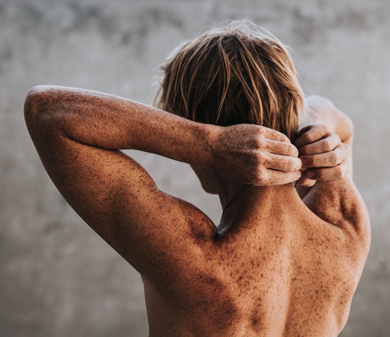What It’s Really Like To Treat Hyperpigmentation